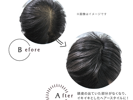 分け目が薄い女性の原因と対策｜自然にボリュームを増やす方法