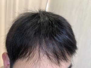 水戸でかつらを作るならヘアピットにどうぞ